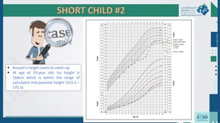 SHORT CHILD #2
 Bassam’s height starts to catch-up
 At age of 19-year old, his height is
168cm which is within the range of
calculated mid-parental height (155.5 –
175.5)
●
●
●
●
●
●
●
●
●
●
● ● ● ●
●
●
●
●
●
●
Dr.
Majdi
AlJasim
 