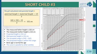 SHORT CHILD #3
 The measured father height is 165 cm
 The measured mother height is 152 cm
 Projected height is 152 cm
 Mid-parental height is 152 cm
 The accepted range is (142 – 162)
 The projected height is within the range
 Bone age is normal for age
 The curve is parallel to other centiles
Dr.
Majdi
AlJasim
●
●
●
●
●
●
●
●
●
●
●
●
●
●
●
The girl calculated mid-parental height =
𝑝𝑎𝑡𝑒𝑟𝑛𝑎𝑙 ℎ𝑒𝑖𝑔ℎ𝑡 + 𝑚𝑎𝑡𝑒𝑟𝑛𝑎𝑙 ℎ𝑒𝑖𝑔ℎ𝑡 − 13
2
165 + 152 − 13
2
= 152 𝑐𝑚
●
●
●
●
●
Potential
height
 
