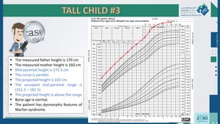 TALL CHILD #3
 The measured father height is 170 cm
 The measured mother height is 160 cm
 Mid-parental height is 171.5 cm
 The curve is parallel.
 The projected height is 210 cm.
 The accepted mid-parental range is
(161.5 – 181.5)
 The projected height is above the range
 Bone age is normal.
 The patient has dysmorphic features of
Marfan syndrome.
Dr.
Majdi
AlJasim
●
●
●
●
●
●
●
●
●
●
●
● ●
 