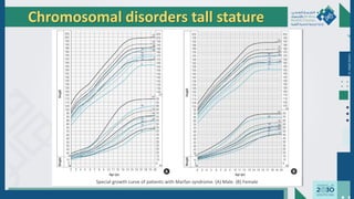 Dr.
Majdi
AlJasim
Chromosomal disorders tall stature
Special growth curve of patients with Marfan syndrome. (A) Male. (B) Female
 