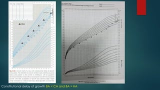 Constitutional delay of growth BA < CA and BA = HA
 