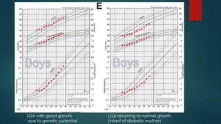 LGA with good growth
due to genetic potential
LGA returning to normal growth
(infant of diabetic mother)
 