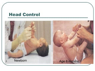 Head Control

Newborn

Age 6 months

 