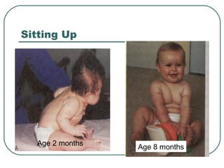 Sitting Up

Age 2 months

Age 8 months

 