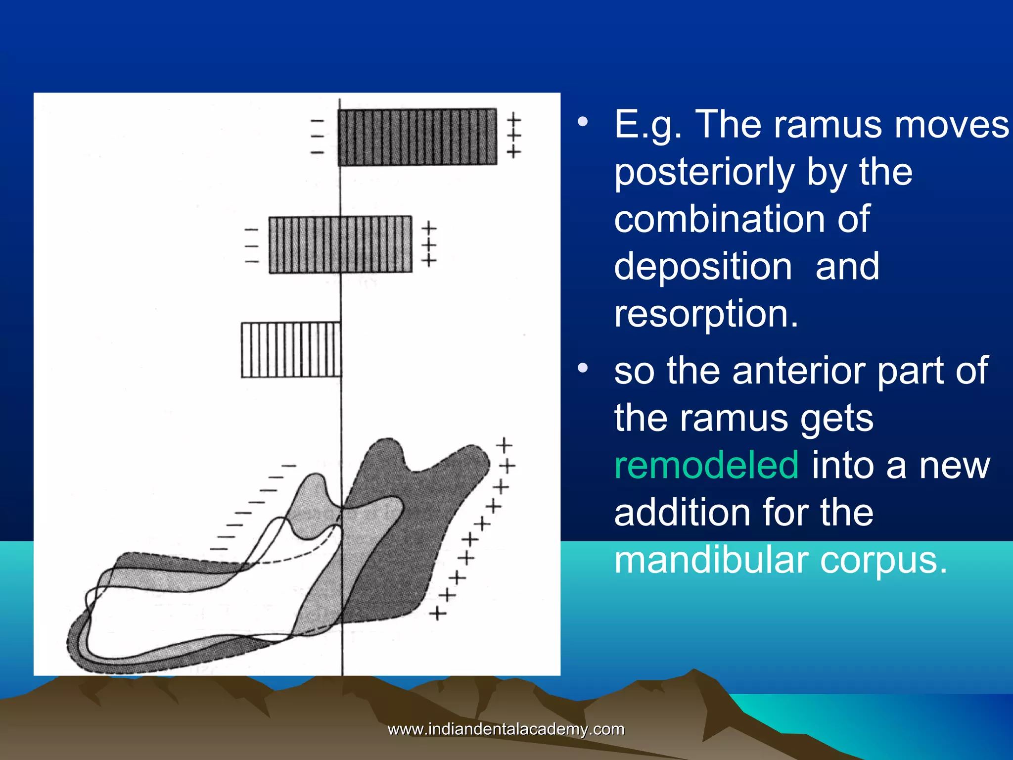 • E.g. The ramus moves
posteriorly by the
combination of
deposition and
resorption.
• so the anterior part of
the ramus gets
remodeled into a new
addition for the
mandibular corpus.
www.indiandentalacademy.comwww.indiandentalacademy.com
 