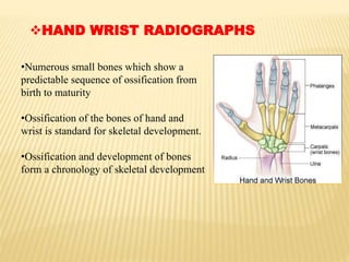 HAND WRIST RADIOGRAPHS
•Numerous small bones which show a
predictable sequence of ossification from
birth to maturity
•Ossification of the bones of hand and
wrist is standard for skeletal development.
•Ossification and development of bones
form a chronology of skeletal development
 