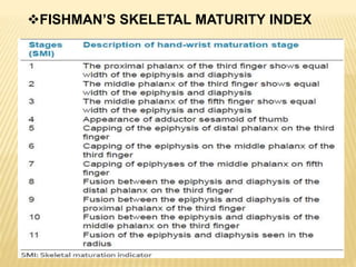 FISHMAN’S SKELETAL MATURITY INDEX
 
