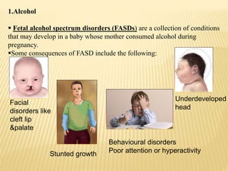 1.Alcohol
 Fetal alcohol spectrum disorders (FASDs) are a collection of conditions
that may develop in a baby whose mother consumed alcohol during
pregnancy.
Some consequences of FASD include the following:
Facial
disorders like
cleft lip
&palate
Stunted growth
Behavioural disorders
Poor attention or hyperactivity
Underdeveloped
head
 