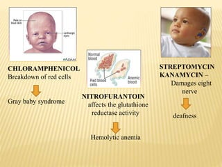 CHLORAMPHENICOL
Breakdown of red cells
Gray baby syndrome
STREPTOMYCIN
KANAMYCIN –
Damages eight
nerve
deafness
NITROFURANTOIN
affects the glutathione
reductase activity
Hemolytic anemia
 