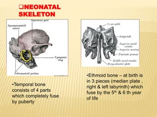 NEONATAL
SKELETON
•Ethmoid bone – at birth is
in 3 pieces (median plate ,
right & left labyrinth) which
fuse by the 5th & 6 th year
of life
•Temporal bone
consists of 4 parts
which completely fuse
by puberty
 
