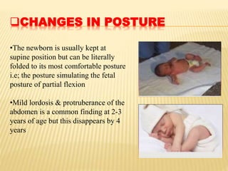 CHANGES IN POSTURE
•The newborn is usually kept at
supine position but can be literally
folded to its most comfortable posture
i.e; the posture simulating the fetal
posture of partial flexion
•Mild lordosis & protruberance of the
abdomen is a common finding at 2-3
years of age but this disappears by 4
years
 