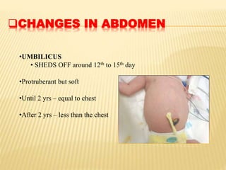 CHANGES IN ABDOMEN
•UMBILICUS
• SHEDS OFF around 12th to 15th day
•Protruberant but soft
•Until 2 yrs – equal to chest
•After 2 yrs – less than the chest
 