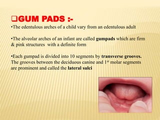 GUM PADS :-
•The edentulous arches of a child vary from an edentulous adult
•The alveolar arches of an infant are called gumpads which are firm
& pink structures with a definite form
•Each gumpad is divided into 10 segments by transverse grooves.
The grooves between the deciduous canine and 1st molar segments
are prominent and called the lateral sulci
 