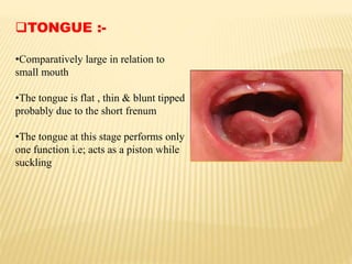 TONGUE :-
•Comparatively large in relation to
small mouth
•The tongue is flat , thin & blunt tipped
probably due to the short frenum
•The tongue at this stage performs only
one function i.e; acts as a piston while
suckling
 