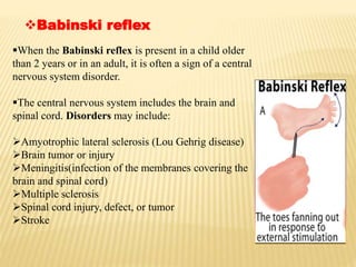 Babinski reflex
When the Babinski reflex is present in a child older
than 2 years or in an adult, it is often a sign of a central
nervous system disorder.
The central nervous system includes the brain and
spinal cord. Disorders may include:
Amyotrophic lateral sclerosis (Lou Gehrig disease)
Brain tumor or injury
Meningitis(infection of the membranes covering the
brain and spinal cord)
Multiple sclerosis
Spinal cord injury, defect, or tumor
Stroke
 