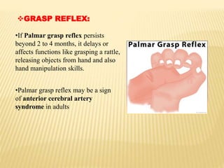 GRASP REFLEX:
•If Palmar grasp reflex persists
beyond 2 to 4 months, it delays or
affects functions like grasping a rattle,
releasing objects from hand and also
hand manipulation skills.
•Palmar grasp reflex may be a sign
of anterior cerebral artery
syndrome in adults
 