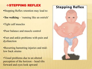Stepping Reflex retention may lead to:
•Toe walking – ‘running like an ostrich’
•Tight calf muscles
•Poor balance and muscle control
•Feet and ankle problems with pain and
dysfunction
•Recurring hamstring injuries and mid-
low back strains
•Visual problems due to an altered
perception of the horizon – head tilts
forward and eyes look upward
STEPPING REFLEX
 