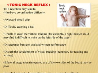 TONIC NECK REFLEX :
TNR retention may lead to:
•Hand-eye co-ordination difficulty
•Awkward pencil grip
•Difficulty catching a ball
•Unable to cross the vertical midline (for example, a right-handed child
may find it difficult to write on the left side of the page)
•Discrepancy between oral and written performance
•Disturb the development of visual tracking (necessary for reading and
writing)
•Bilateral integration (integrated use of the two sides of the body) may be
poor.
 