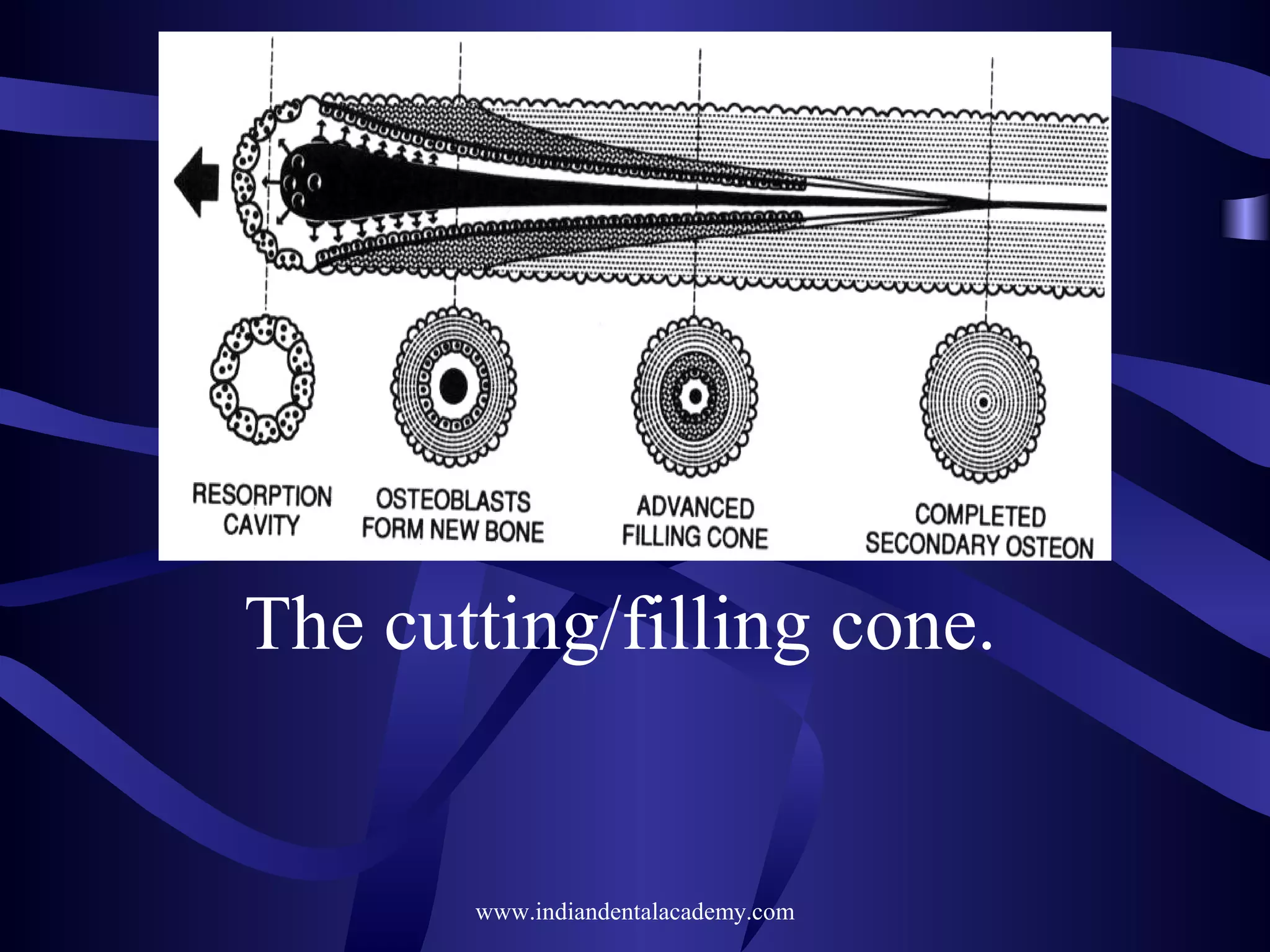 The cutting/filling cone.
www.indiandentalacademy.com
 