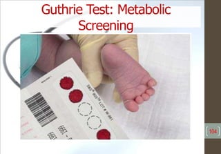 Guthrie Test: Metabolic
Screening
104
 