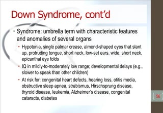 Down Syndrome, cont’d
• Syndrome: umbrella term with characteristic features
and anomalies of several organs
• Hypotonia, single palmar crease, almond-shaped eyes that slant
up, protruding tongue, short neck, low-set ears, wide, short neck,
epicanthal eye folds
• IQ in mildly-to-moderately low range; developmental delays (e.g.,
slower to speak than other children)
• At risk for: congenital heart defects, hearing loss, otitis media,
obstructive sleep apnea, strabismus, Hirschsprung disease,
thyroid disease, leukemia, Alzheimer’s disease, congenital
cataracts, diabetes 56
 