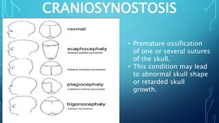EMBRYOLOGY,GROWTH & DEVELOPMENT OF CRANIUM & CRANIAL BASE IRT ...