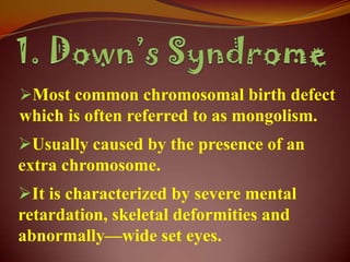 Most common chromosomal birth defect
which is often referred to as mongolism.
Usually caused by the presence of an
extra chromosome.
It is characterized by severe mental
retardation, skeletal deformities and
abnormally—wide set eyes.
 