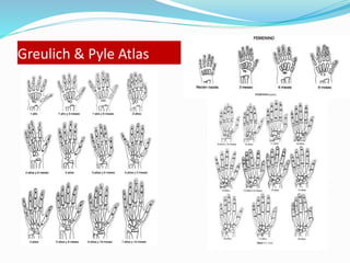 Greulich & Pyle Atlas
 