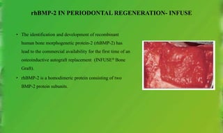 rhBMP-2 IN PERIODONTAL REGENERATION- INFUSE
• The identification and development of recombinant
human bone morphogenetic protein-2 (rhBMP-2) has
lead to the commercial availability for the first time of an
osteoinductive autograft replacement (INFUSE® Bone
Graft).
• rhBMP-2 is a homodimeric protein consisting of two
BMP-2 protein subunits.
 