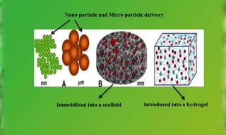 Nano particle and Micro particle delivery
Immobilised into a scaffold Introduced into a hydrogel
 