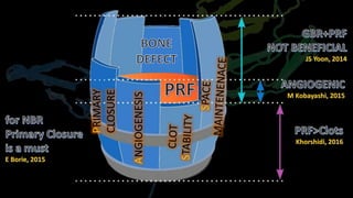 ANGIOGENESIS
PRIMARY
CLOSURE
Khorshidi, 2016
M Kobayashi, 2015
JS Yoon, 2014
E Borie, 2015
 