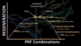 REGENERATION
PRF Combinations
 