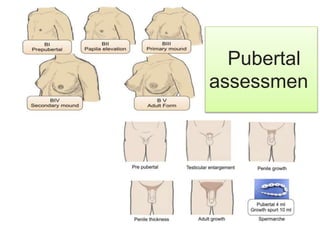 • First sign of puberty in boys is increase in
testicular size followed by appearance of pubic
hairs and increase in penil...