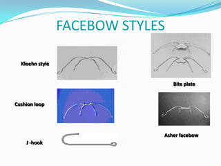 FACEBOW STYLES

  Kloehn style


                                  Bite plate


Cushion loop




                              Asher facebow
    J -hook
 