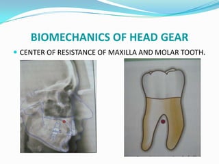 BIOMECHANICS OF HEAD GEAR
 CENTER OF RESISTANCE OF MAXILLA AND MOLAR TOOTH.
 
