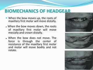 BIOMECHANICS OF HEADGEAR
 When the bow moves up, the roots of
  maxillary first molar will move distally.
. When the bow moves down, the roots
  of maxillary first molar will move
  mesially and crown distally.
. When the bow does not move. The
  force is through the center of
  resistance of the maxillary first molar
  and molar will move bodily and not
  rotate.
 