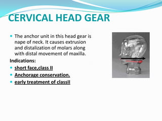 CERVICAL HEAD GEAR
 The anchor unit in this head gear is
  nape of neck. It causes extrusion
  and distalization of molars along
  with distal movement of maxilla.
Indications:
 short face,class II
 Anchorage conservation.
 early treatment of classII
 