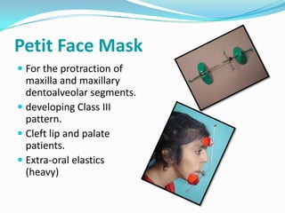 Petit Face Mask
 For the protraction of
  maxilla and maxillary
  dentoalveolar segments.
 developing Class III
  pattern.
 Cleft lip and palate
  patients.
 Extra-oral elastics
  (heavy)
 