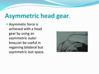 Asymmetric head gear.
 Asymmetic force is
  achieved with a head
  gear by using an
  asymmetric outer
  bow,can be useful in
  regaining bilateral but
  asymmetric lost space.
 