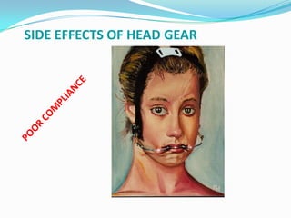 SIDE EFFECTS OF HEAD GEAR
 