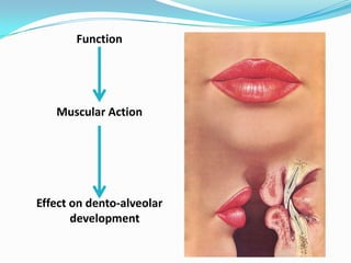 Function




   Muscular Action




Effect on dento-alveolar
       development
 