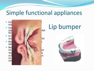 Simple functional appliances
 Can be used for both mand and
    maxilla
   Uses the muscular force from
    upper or lower lip to provide distal
                                           Lip bumper
    force specially to molars
   In lower arch headgear is less
    acceptable so lip bumper is useful
   Remove soft tissues forces from
    labial aspect
   Result increased lower incisor
    inclination by influence of tongue
    This can be reduced by placing it
    as low as possible in labial sulcus
    so that upper part of lip is in
    contact with teeth
 