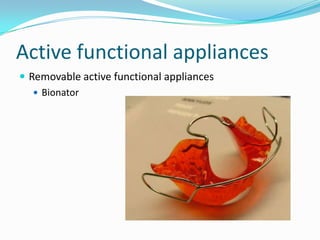 Active functional appliances
 Removable active functional appliances
    Bionator
 
