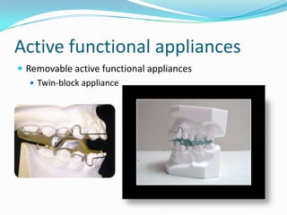 Active functional appliances
 Removable active functional appliances
    Twin-block appliance
 