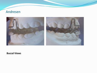 Andresen




Buccal Views
 