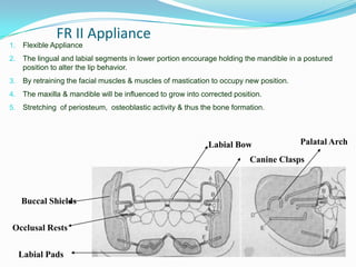 FR II Appliance
1.    Flexible Appliance
2.    The lingual and labial segments in lower portion encourage holding the mandible in a postured
      position to alter the lip behavior.
3.    By retraining the facial muscles & muscles of mastication to occupy new position.
4.    The maxilla & mandible will be influenced to grow into corrected position.
5.    Stretching of periosteum, osteoblastic activity & thus the bone formation.




                                                               Labial Bow                 Palatal Arch

                                                                            Canine Clasps



     Buccal Shields


 Occlusal Rests


     Labial Pads
 
