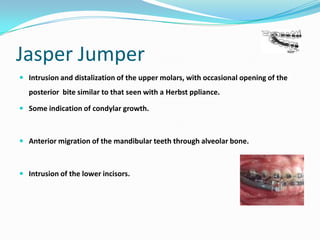 Jasper Jumper
 Intrusion and distalization of the upper molars, with occasional opening of the
  posterior bite similar to that seen with a Herbst ppliance.

 Some indication of condylar growth.



 Anterior migration of the mandibular teeth through alveolar bone.



 Intrusion of the lower incisors.
 