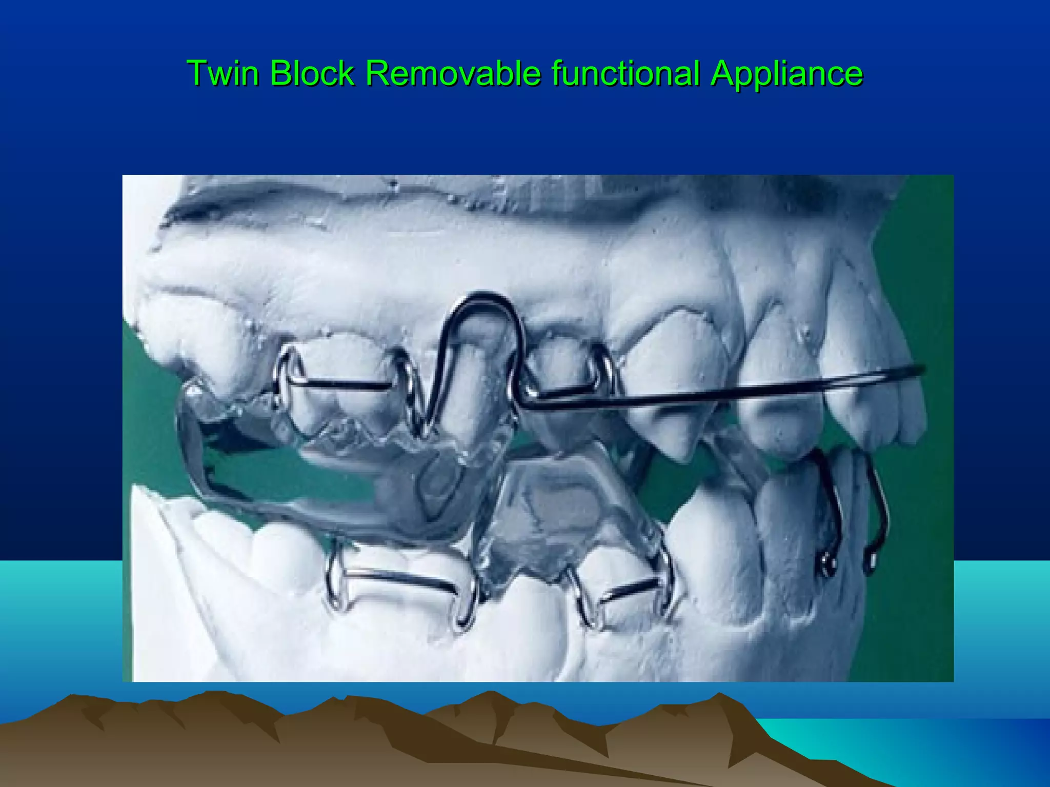 Twin Block Removable functional ApplianceTwin Block Removable functional Appliance
 