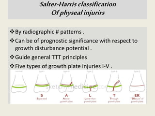 By radiographic # patterns .
Can be of prognostic significance with respect to
growth disturbance potential .
Guide general TTT principles
Five types of growth plate injuries I-V .
Salter-Harrisclassification
Ofphysealinjurirs
 