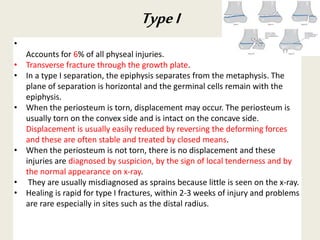•
Accounts for 6% of all physeal injuries.
• Transverse fracture through the growth plate.
• In a type I separation, the epiphysis separates from the metaphysis. The
plane of separation is horizontal and the germinal cells remain with the
epiphysis.
• When the periosteum is torn, displacement may occur. The periosteum is
usually torn on the convex side and is intact on the concave side.
Displacement is usually easily reduced by reversing the deforming forces
and these are often stable and treated by closed means.
• When the periosteum is not torn, there is no displacement and these
injuries are diagnosed by suspicion, by the sign of local tenderness and by
the normal appearance on x-ray.
• They are usually misdiagnosed as sprains because little is seen on the x-ray.
• Healing is rapid for type I fractures, within 2-3 weeks of injury and problems
are rare especially in sites such as the distal radius.
TypeI
 